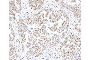 Immunohistochemistry (IHC) image for anti-CCCTC-Binding Factor (Zinc Finger Protein) (CTCF) (AA 650-700) antibody (ABIN7453967) (Rekombinanter CTCF Antikörper  (AA 650-700))
