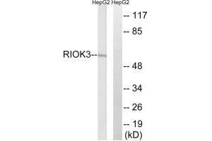 Western blot analysis of extracts from HepG2 cells, using RIOK3 antibody. (RIOK3 Antikörper)