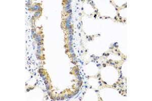 Immunohistochemistry of paraffin-embedded rat lung using C8orf4 antibody at dilution of 1:100 (40x lens). (C8orf4 Antikörper)