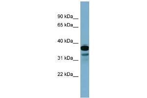WB Suggested Anti-FLJ25791 Antibody Titration: 0. (FLJ25791 (Middle Region) Antikörper)
