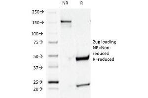 SDS-PAGE Analysis Purified CD44v4 Mouse Monoclonal Antibody (CD44v4/1219). (CD44 Antikörper)