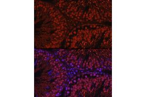 Immunofluorescence analysis of rat testis using C1orf146 Rabbit pAb (ABIN7266368) at dilution of 1:100 (40x lens). (C1ORF146 Antikörper)