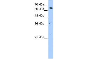 WB Suggested Anti-MLSTD2 Antibody Titration:  1. (FAR1 Antikörper  (N-Term))