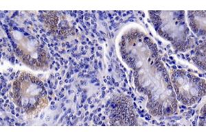 Immunohistochemistry (IHC) image for anti-Caspase 6, Apoptosis-Related Cysteine Peptidase (CASP6) (AA 81-179) antibody (ABIN7437551)