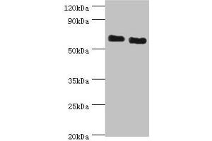 Western blot All lanes: ATAD3B antibody at 2 μg/mL Lane 1: Jurkat whole cell lysate Lane 2: Hela whole cell lysate Secondary Goat polyclonal to rabbit IgG at 1/10000 dilution Predicted band size: 73, 20, 68 kDa Observed band size: 73 kDa (ATAD3B Antikörper  (AA 1-240))