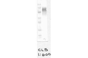 Image no. 1 for anti-Cytochrome B-245, beta Polypeptide (CYBB) antibody (ABIN1042597)