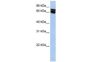 B4GALNT1 antibody used at 1 ug/ml to detect target protein. (B4GALNT1 Antikörper  (N-Term))