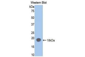 Detection of Recombinant F2, Rat using Monoclonal Antibody to Coagulation Factor II (F2) (Prothrombin Antikörper  (AA 201-323))