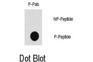 Dot blot analysis of MAP3K7 (phospho T187) polyclonal antibody  on nitrocellulose membrane.