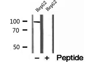 Western blot analysis of extracts of HepG2 cells, using MCM10 antibody. (MCM10 Antikörper  (C-Term))