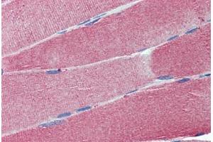 Human Skeletal Muscle: Formalin-Fixed, Paraffin-Embedded (FFPE) (Cell Adhesion Molecule 4 Antikörper  (AA 73-83))