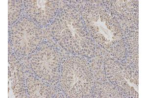 Immunohistochemistry (IHC) image for anti-Cytidine Deaminase (CDA) antibody (ABIN1871668) (CDA Antikörper)