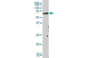 CHEK2 monoclonal antibody (M04), clone 4F10 Western Blot analysis of CHEK2 expression in Hela S3 NE . (CHEK2 Antikörper  (AA 1-543))