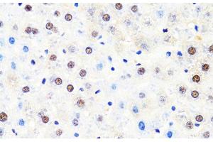 Immunohistochemistry of paraffin-embedded Rat liver using POLR2B Polyclonal Antibody at dilution of 1:100 (40x lens). (POLR2B Antikörper)