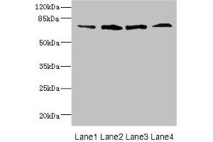 Western blot All lanes: DARS2 antibody at 16 μg/mL Lane 1: Mouse heart tissue Lane 2: Mouse liver tissue Lane 3: Mouse brain tissue Lane 4: Mouse skeletal muscle tissue Secondary Goat polyclonal to rabbit IgG at 1/10000 dilution Predicted band size: 73 kDa Observed band size: 73 kDa (FLRT3 Antikörper  (AA 209-264))