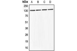 Western blot analysis of ABL1/2 expression in HeLa (A), HEK293T (B), Raw264. (ABL1/2 Antikörper  (C-Term))