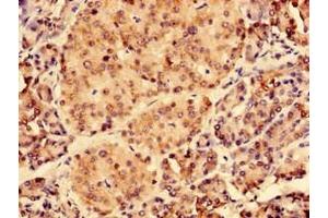 Immunohistochemistry of paraffin-embedded human pancreatic tissue using ABIN7147383 at dilution of 1:100 (CEP126 Antikörper  (AA 559-670))