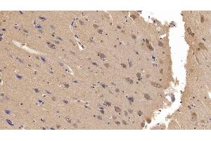 Immunohistochemistry (IHC) image for anti-Ubiquitin (Ub) (AA 1-229) antibody (ABIN7428593)