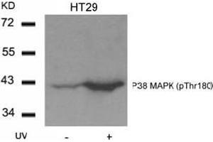 Image no. 1 for anti-Mitogen-Activated Protein Kinase 14 (MAPK14) (pThr180) antibody (ABIN197010) (MAPK14 Antikörper  (pThr180))