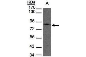 Western Blotting (WB) image for anti-GIT1 (GIT1) (Internal Region) antibody (ABIN2856197)