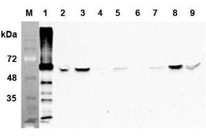 Western blot analysis of human FTO using anti-human FTO mAb (AG103)  at 1:1,000 dilution: 1. (FTO Antikörper)