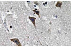 Immunohistochemistry (IHC) analyzes of Ob-R antibody in paraffin-embedded human brain tissue. (Leptin Receptor Antikörper)