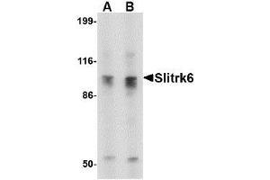 Image no. 1 for anti-SLIT and NTRK-Like Family, Member 6 (SLITRK6) (C-Term) antibody (ABIN1492200) (SLITRK6 Antikörper  (C-Term))