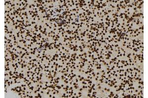 ABIN6276460 at 1/100 staining Mouse kidney tissue by IHC-P. (ENO1 Antikörper  (C-Term))