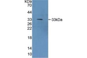 Detection of Recombinant METRN, Mouse using Polyclonal Antibody to Meteorin (METRN) (METRN Antikörper  (AA 22-291))