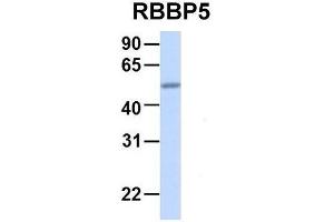 Host:  Rabbit  Target Name:  RBBP5  Sample Type:  Human Adult Placenta  Antibody Dilution:  1. (RBBP5 Antikörper  (Middle Region))