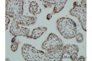 Image no. 3 for anti-Far Upstream Element (FUSE) Binding Protein 1 (FUBP1) (AA 27-137) antibody (ABIN599075) (FUBP1 Antikörper  (AA 27-137))