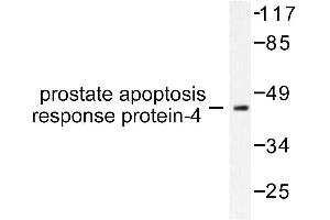 Image no. 1 for anti-PRKC, Apoptosis, WT1, Regulator (PAWR) antibody (ABIN271791) (PAWR Antikörper)