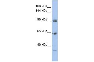 WB Suggested Anti-TPCN1 Antibody Titration:  0.
