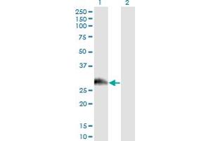 Western Blot analysis of PAGE1 expression in transfected 293T cell line by PAGE1 monoclonal antibody (M01), clone 6G6. (PAGE1 Antikörper  (AA 1-146))