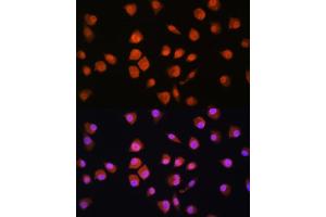 Immunofluorescence analysis of L929 cells using NPLOC4 Rabbit pAb (ABIN1681086, ABIN5664262, ABIN5664264 and ABIN6220175) at dilution of 1:100. (NPLOC4 Antikörper  (AA 1-270))