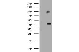 Image no. 2 for anti-Melanoma Antigen Family A, 3 (MAGEA3) antibody (ABIN1499253)