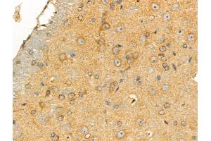 ABIN6258464 and ABIN6274298 at 1/100 staining Rat brain tissue by IHC-P. (CKS1 Antikörper  (N-Term))
