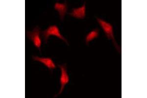 ABIN6273930 staining COLO205 by IF/ICC. (GPR176 Antikörper  (C-Term))