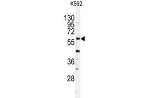 Western blot analysis of USP2 polyclonal antibody  in K-562 cell line lysates (35 ug/lane).
