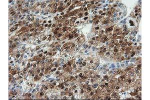 Image no. 4 for anti-Aminoacylase 1 (ACY1) antibody (ABIN1496456) (Aminoacylase 1 Antikörper)