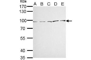 WB Image MVP/LRP antibody detects MVP protein by Western blot analysis. (MVP Antikörper)