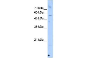 Western Blot showing SEPN1 antibody used at a concentration of 1-2 ug/ml to detect its target protein. (SEPN1 Antikörper  (C-Term))