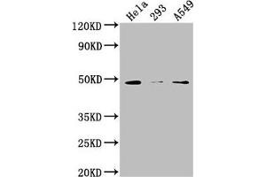 Western Blot Positive WB detected in: Hela whole cell lysate, 293 whole cell lysate, A549 whole cell lysate All lanes: NXN antibody at 1:2000 Secondary Goat polyclonal to rabbit IgG at 1/50000 dilution Predicted band size: 49, 21, 37 kDa Observed band size: 49 kDa (NXN Antikörper  (AA 155-435))