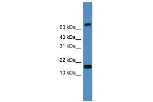 WB Suggested Anti-CST9 Antibody Titration: 0. (CST9 Antikörper  (Middle Region))