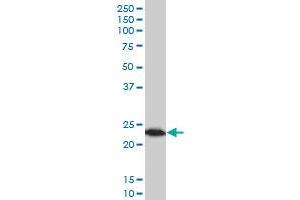 TPT1 monoclonal antibody (M03), clone 2C4 Western Blot analysis of TPT1 expression in MCF-7 . (TPT1 Antikörper  (AA 35-138))