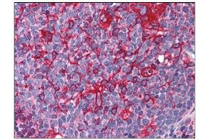 Human Tonsil: Formalin-Fixed, Paraffin-Embedded (FFPE) (ARL6IP5 Antikörper  (C-Term))