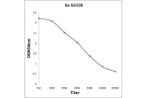ELISA image for anti-Nuclear Factor of kappa Light Polypeptide Gene Enhancer in B-Cells 1 (NFKB1) (pSer893) antibody (ABIN710666)