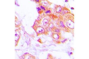 Immunohistochemistry (IHC) image for anti-GIT1 (GIT1) (C-Term) antibody (ABIN7298086)