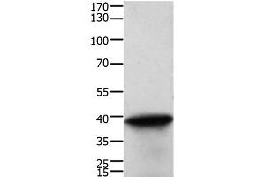 Western Blot analysis of Human cervical cancer tissue using TPM2 Polyclonal Antibody at dilution of 1:600 (TPM2 Antikörper)