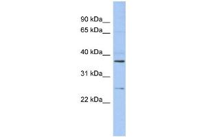 WB Suggested Anti-ZFAND6 Antibody Titration: 0.